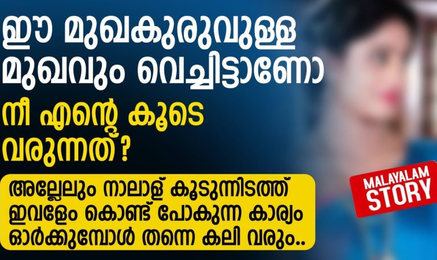 മുഖക്കുരുവിന്റെ പേരിൽ ഭാര്യയെ വെറുത്ത ഭർത്താവിനു കിട്ടിയ പണി കണ്ടോ..