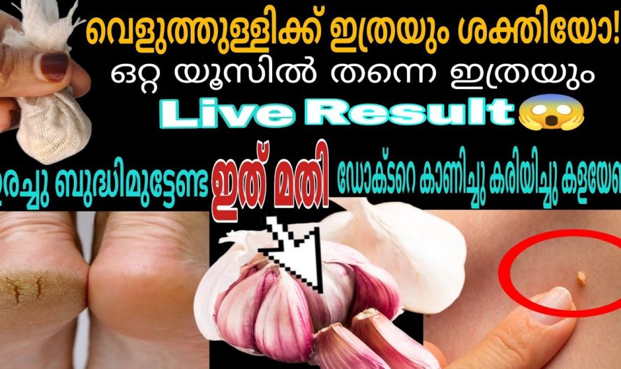 സ്കിന്നിൽ ഉണ്ടാകുന്ന ആരോഗ്യപ്രശ്നങ്ങൾ വെളുത്തുള്ളി കൊണ്ട് പരിഹരിക്കാം…