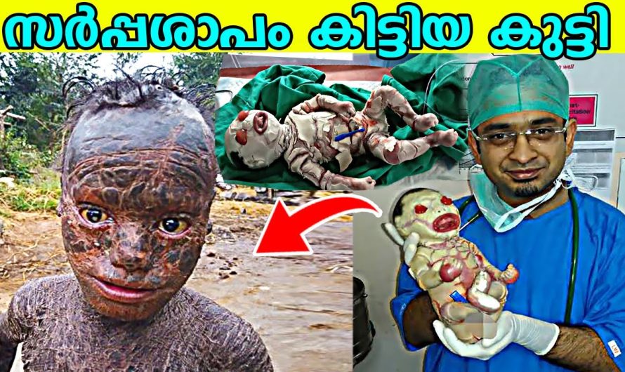 മറ്റ് എല്ലാ മനുഷ്യരിൽ നിന്നും തികച്ചും വ്യത്യസ്തരായി നിൽക്കുന്ന ആളുകൾ..