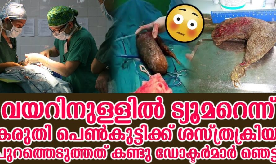 17 വയസ്സുകാരിയുടെ വയറിൻറെ ഉള്ളിൽ നിന്നും ഓപ്പറേഷൻ ചെയ്ത് കിട്ടിയ വസ്തു കണ്ടു ഡോക്ടർമാർ ഞെട്ടിപ്പോയി..