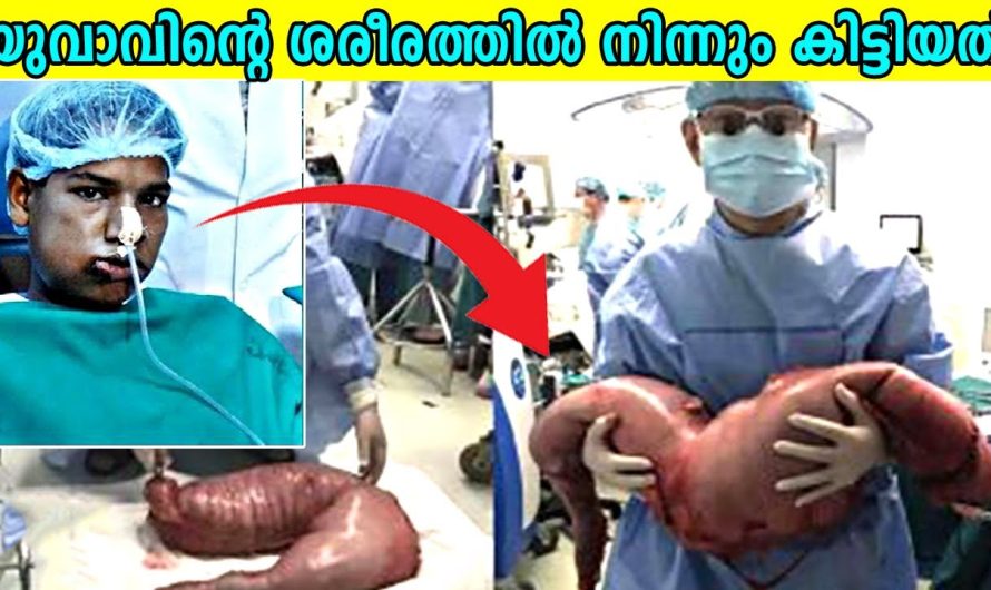 ലോകത്തിൽ നിന്നും കണ്ടെത്തിയ വിചിത്രമായ വസ്തുക്കൾ..