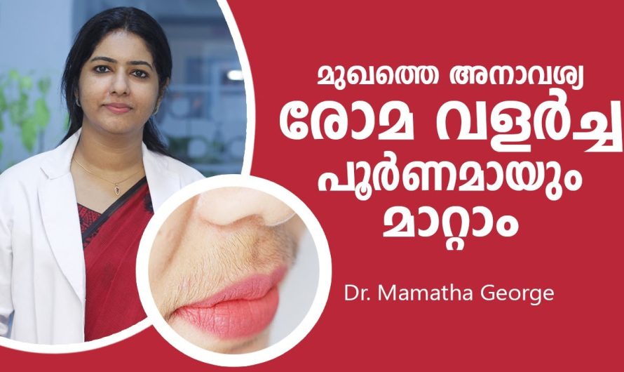 ചെറുപ്പക്കാരായ സ്ത്രീകളിൽ ഉണ്ടാകുന്ന അമിതമായ രോമവളർച്ച..