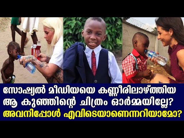 പട്ടിണി മൂലം മരിക്കാൻ സാധ്യതയുണ്ടായിരുന്ന കുഞ്ഞിനോട് ഈ സോഷ്യൽ വർക്കർ ചെയ്തതുകണ്ടോ..