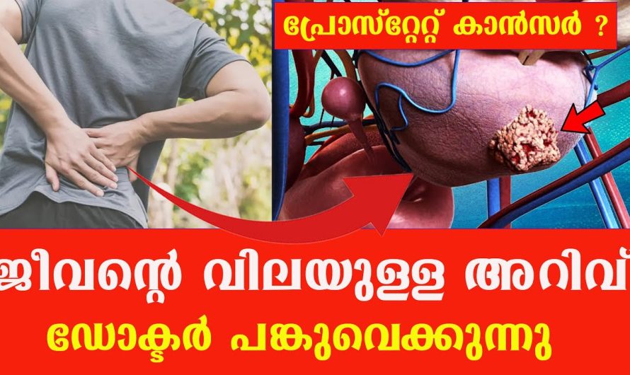 പ്രോ.സ്റ്റേ.റ്റ്. ക്യാ.ൻ.സ.ർ സാധ്യതകളും പ്രധാനപ്പെട്ട ലക്ഷണങ്ങളും..