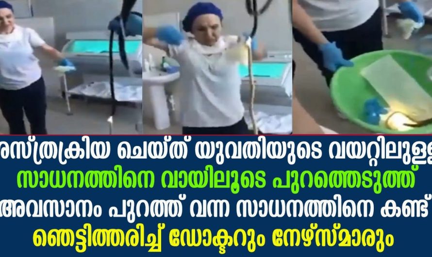 ശസ്ത്രക്രിയ ചെയ്ത യുവതിയുടെ വായിൽ നിന്നും കിട്ടിയ വസ്തു കണ്ട് ഞെട്ടി ഡോക്ടറും നഴ്സുമാരും..