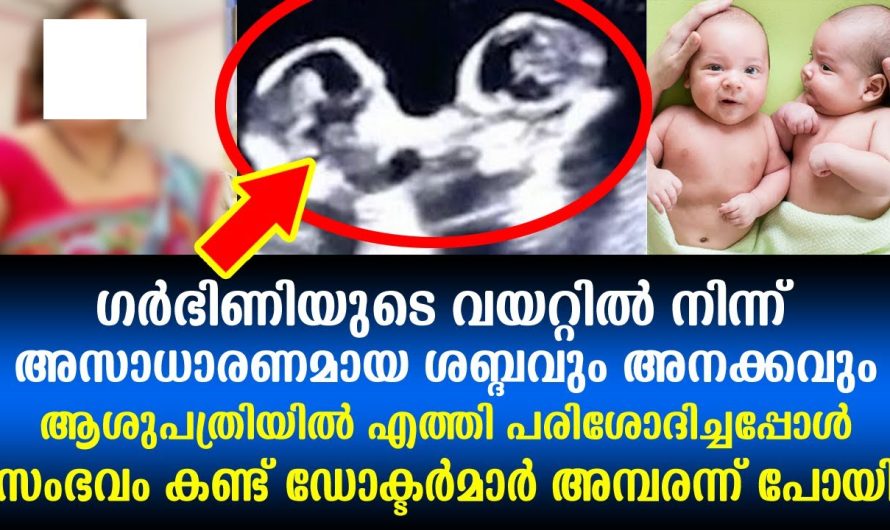 സ്കാനിംഗ് ചിത്രം കണ്ട് അമ്പരന്ന് ഡോക്ടർമാർ,